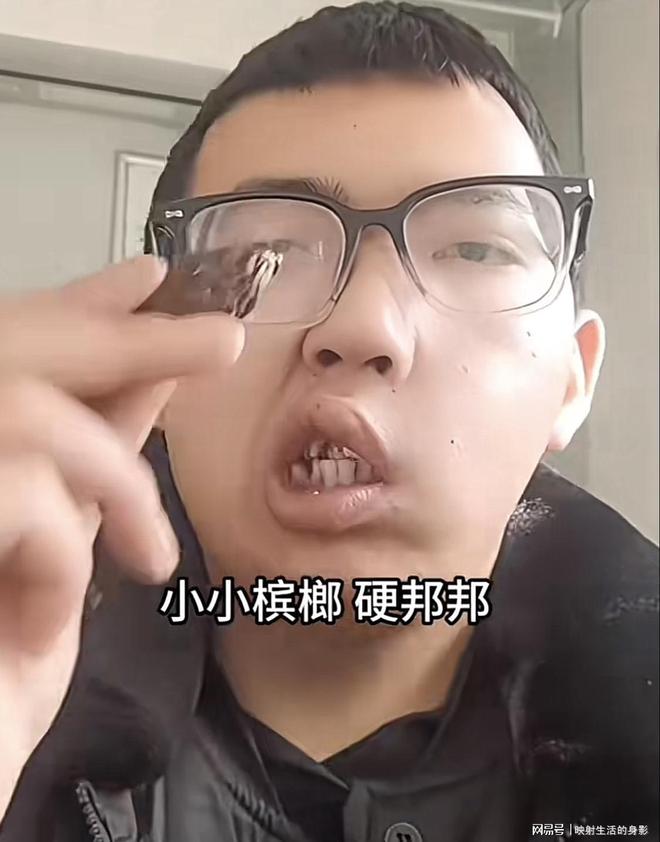 导致脸部变形还边嚼边劝大家别碰槟榔尊龙凯时新版APP男子嚼槟榔七年(图2)